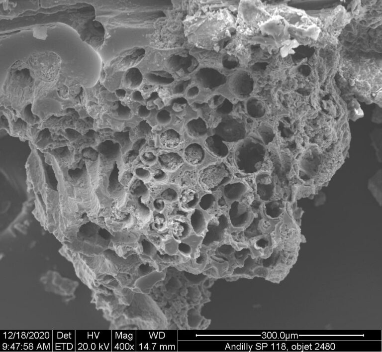 Le tissu vu au microscope électronique à balayage.